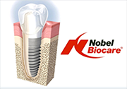 Nobel Biocare