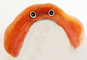 インプラント長期安定性